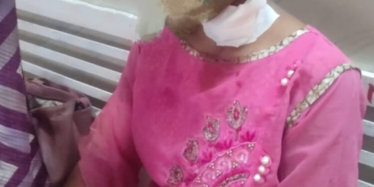 युवक ने युवती को दिन दहाड़े म चाकू मारकर लहूलुहान किया