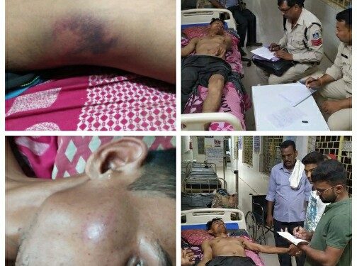 युवक को गिरफ्तार कर पुलिस ने किया मारपीट हाथ फैक्चर, शरीर में आई गंभीर चोटें  पीड़ित युवक ने सिलौंडी पुलिस पर लगाए गंभीर आरोप, ढीमरखेड़ा पुलिस थाना के सिलौंडी पुलिस चौकी में की गई मारपीट