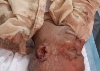 *ट्रैक्टर नदी में पलटने से एक लोग की मौत ,तीन लोग गंभीर से घायल*