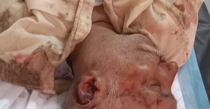 *ट्रैक्टर नदी में पलटने से एक लोग की मौत ,तीन लोग गंभीर से घायल*