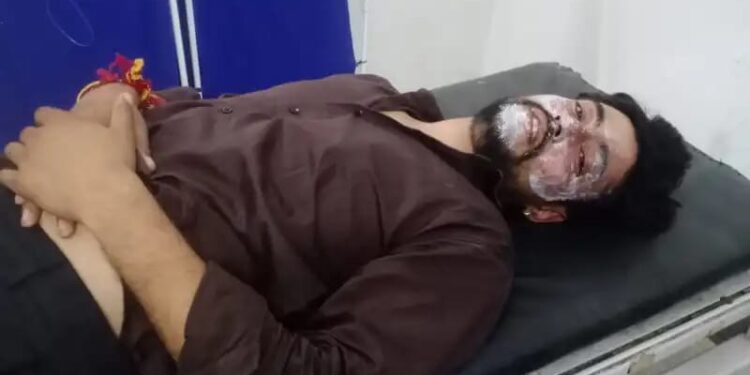 एमसीबी चालू करते हुए बिजली विभाग का गार्ड झुलसा, इलाज कराने की बजाय बिजली विभाग के जेईई ने झुलसे गार्ड की कर दी पिटाई, रास्ते में छोड़ कर भागा अधिकारी
