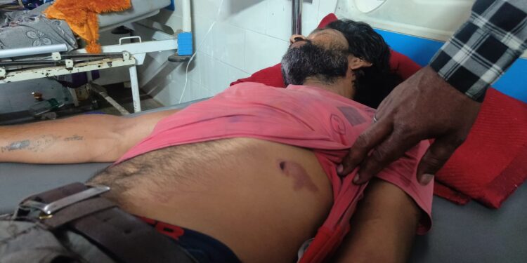 रंग पंचमी की रात छोटे भाई के घर जा रहे युवक की घेरकर की गई पिटाई,युवक गंभीर,जिला अस्पताल में युवक की हालत गंभीर,पुलिस ने दर्ज नहीं किया मामला परिजनों का आरोप…. देखे VIDEO