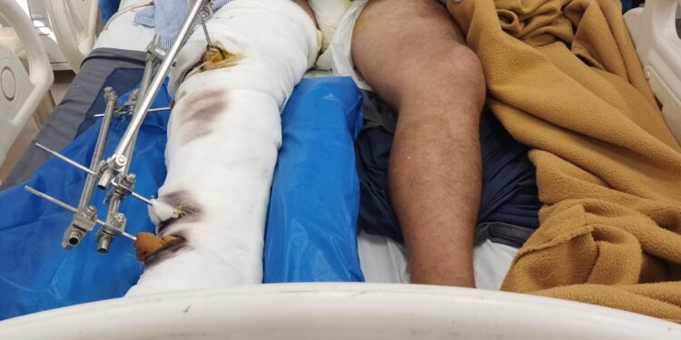 किसान पर घर लौटते वक्त जानलेवा हमला,करीब 5 दिन बाद पुलिस ने साधारण धाराओं में दर्ज किया मामला,उठ रहे गंभीर सवाल..! बुधनी के निजी अस्पताल में गंभीर अवस्था में इलाज जारी,पुलिस अधीक्षक से पीड़ित परिजन ने लगाई न्याय की गुहार…