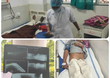*एक्सीडेंट से घायल जिला चिकित्सालय छिंदवाड़ा आईसीयू वार्ड में भर्ती राजेश वर्मा को अभी तक नहीं आया होश*