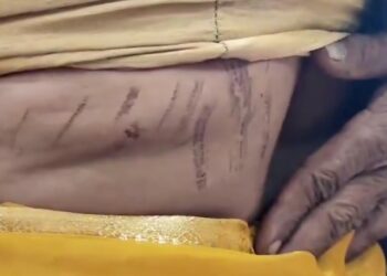 अंधविश्वास के चलते तांत्रिक ने महिला को दी यातनाएं,भूत प्रेत का चक्कर बताकर झाड़ू से पिटाई की गर्म चिमटे से पीठ पर निशान बनाए..देखिऐ VIDEO