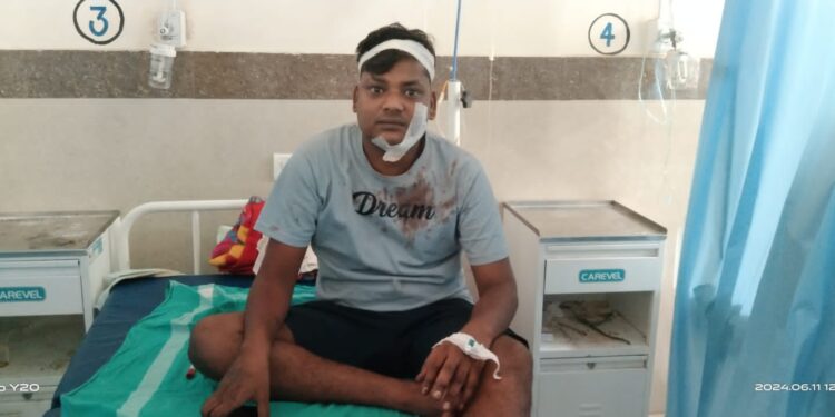 पत्रकार पर असामाजिक तत्व ने किया जान लेवा हमला पत्रकार को सच का आइना दिखाना पड़ा महंगा