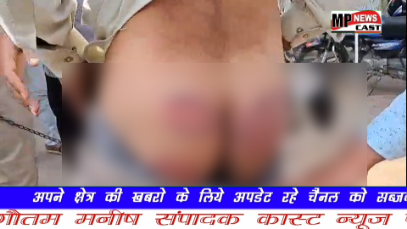 आरोपी को बेहरेमी से पीटने और जाति सूचक शब्दों का प्रयोग करने पर पुलिस पर कार्यवाही की मांग एसडीओपी ने कहा की इस मामले की हम जांच कर रहे
