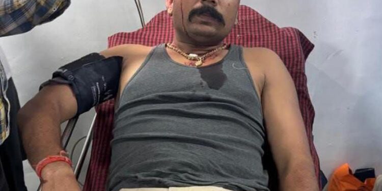 बृजपुर पुलिस हमला मामला: घायल थाना प्रभारी की हालत स्थिर