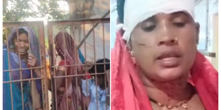 💥जमीनी विवाद में महिला व पुरुष पर जानलेवा हमला — लाठी, रॉड और पत्थर से किया वार💥  घायल महिला व पुरुष का जिला अस्पताल में इलाज VIDEO