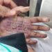 महिला डॉक्टर ने हथेली पर सुसाइड नोट लिख की खुदकुशी, 2 पुलिसकर्मियों पर रेप और प्रताड़ना का आरोप