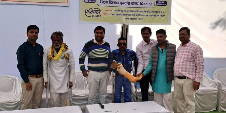 *जिला दिव्यांग पुनर्वास केन्द्र में कृत्रिम अंग चिन्हांकन शिविर आयोजित*