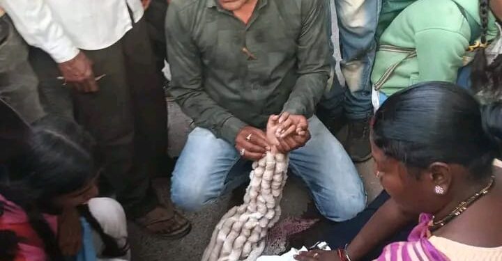 सड़क हादसे में घायल बच्ची को युवक ने CPR देकर बचाई जान, ‘भगवान का अवतार’ बनकर आया फरिश्ता*