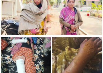पुलिस अधीक्षक से डोलरिया पुलिस द्वारा आरोपियों के खिलाफ कार्यवाही नहीं करने की हुई शिकायत, आरोपी दे रहे जान से मारने की धमकी…!