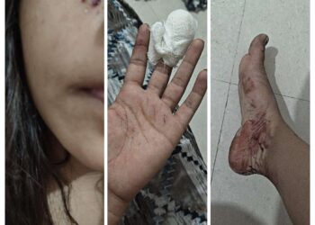 कैफे में युवतियों के बीच विवाद…..  जमकर हुई मारपीट पुलिस ने शुरू की जांच….