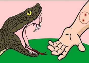 *सांप के काटने पर झाड़-फूंक नहीं, तत्काल अस्पताल पहुंचाएं मरीज*  *एंटी स्नेक वेनम ही बचा सकता है मरीज की जान*