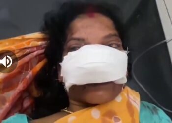 ‘पत्नी के प्रेम-प्रसंग से परेशान पति ने पत्नी की नाक काट दी’ VIDEO