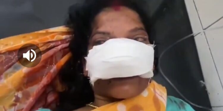 ‘पत्नी के प्रेम-प्रसंग से परेशान पति ने पत्नी की नाक काट दी’ VIDEO