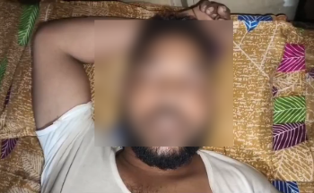 ‘तुम्हें किसा का नहीं होने दुगी’ कहकर पत्नी ने पति का काट दिया प्राइवेट पार्ट’